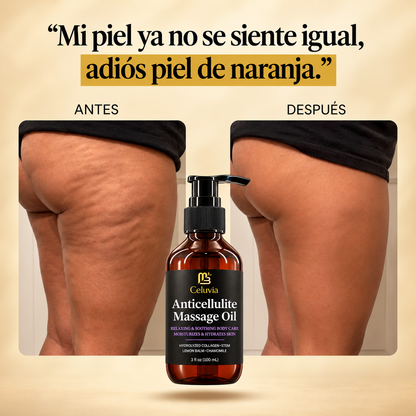 Aceite Anticelulitis Celuvia™