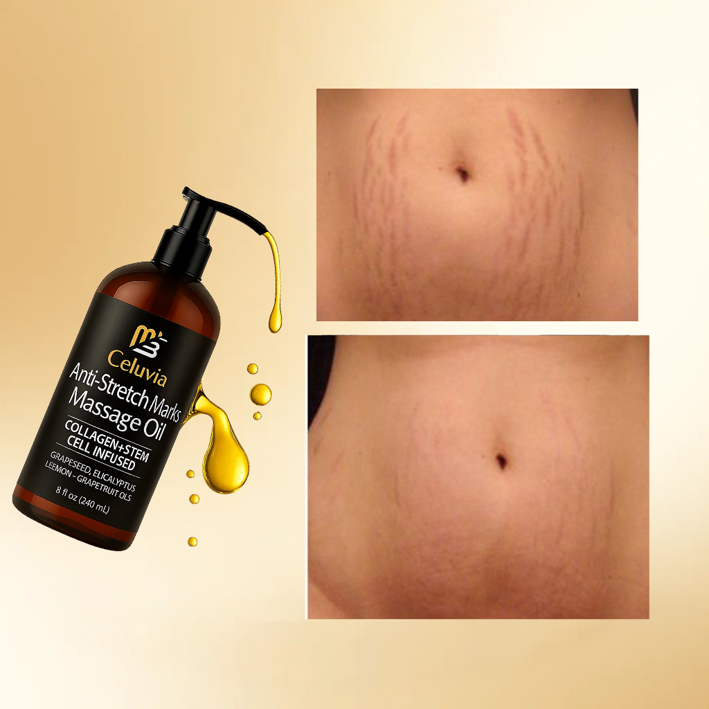 Aceite AntiEstrias abdominal Celuvia™