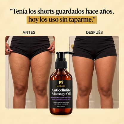 Aceite Anticelulitis Celuvia™