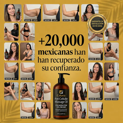 Aceite Antiflacidez de brazos Celuvia™