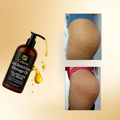 Celuvia™ Anti Estrías