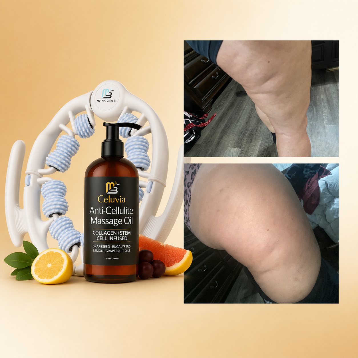 SET Masajeador anti celulitis