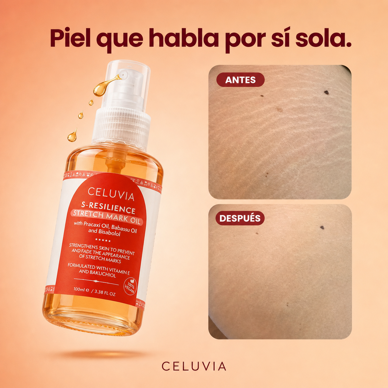 Aceite Anti Estrías Celuvia™