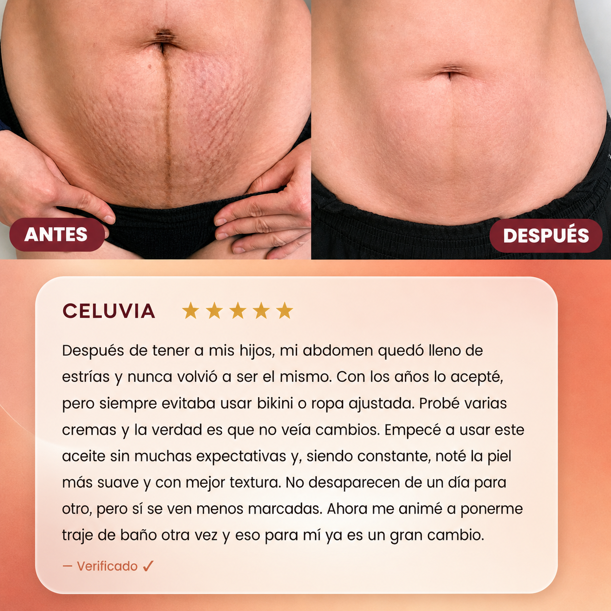 Aceite Anti Estrías Celuvia™